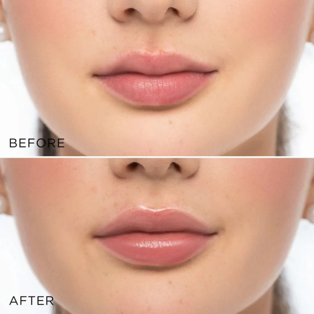 Glossy Lip Volumizer - Image 3