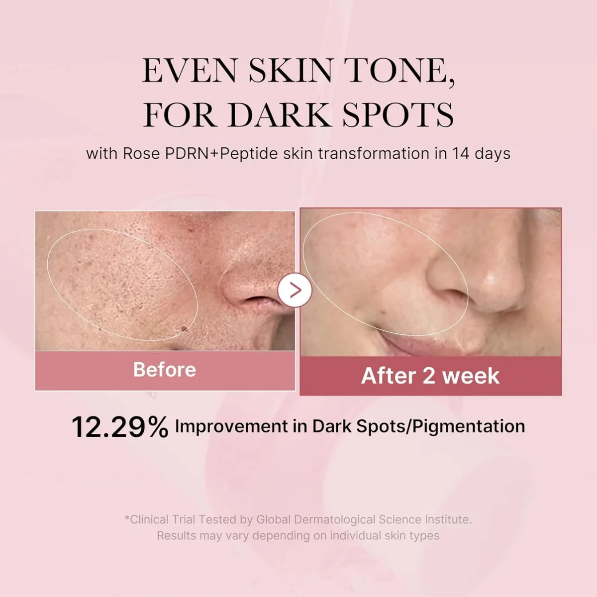 PDRN Pink Cica Soothing Toner 250Ml - Image 3