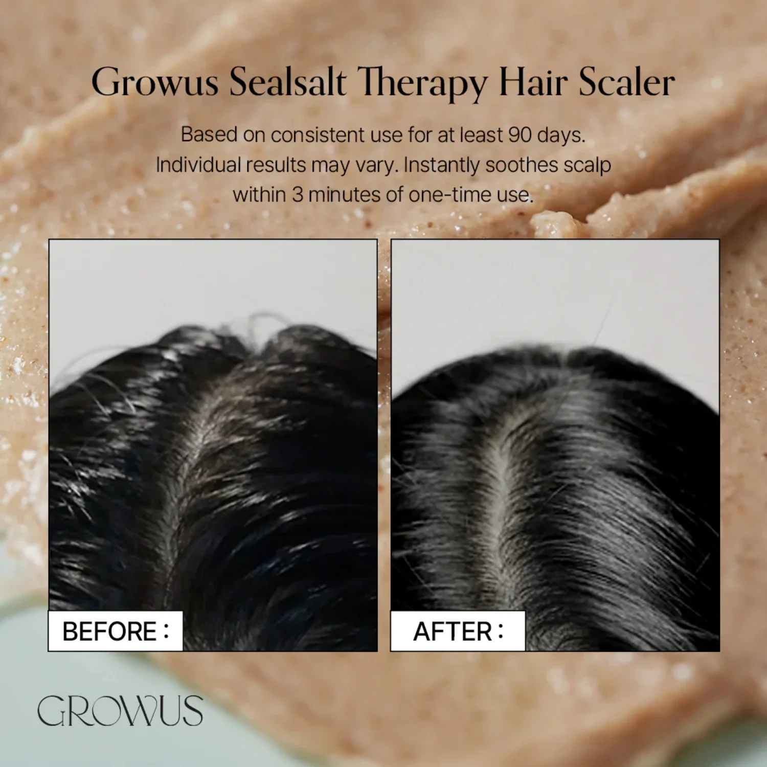 Sea Salt Therapy Scalp Scaler 120g - Image 6