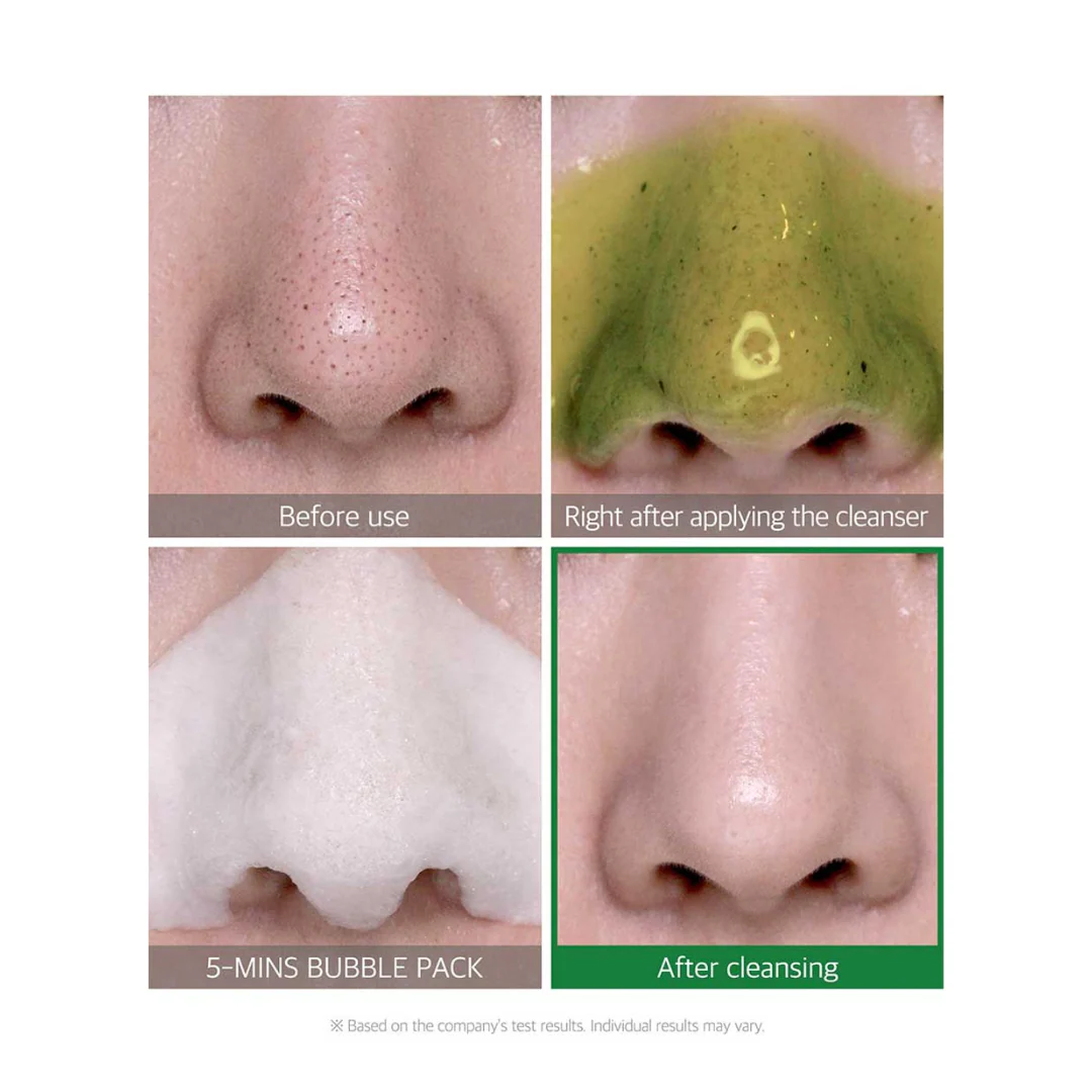 Some By Mi Bye Bye Blackhead 30 Days Miracle Green Tea Tox Bubble Cleanser 120g - Image 3